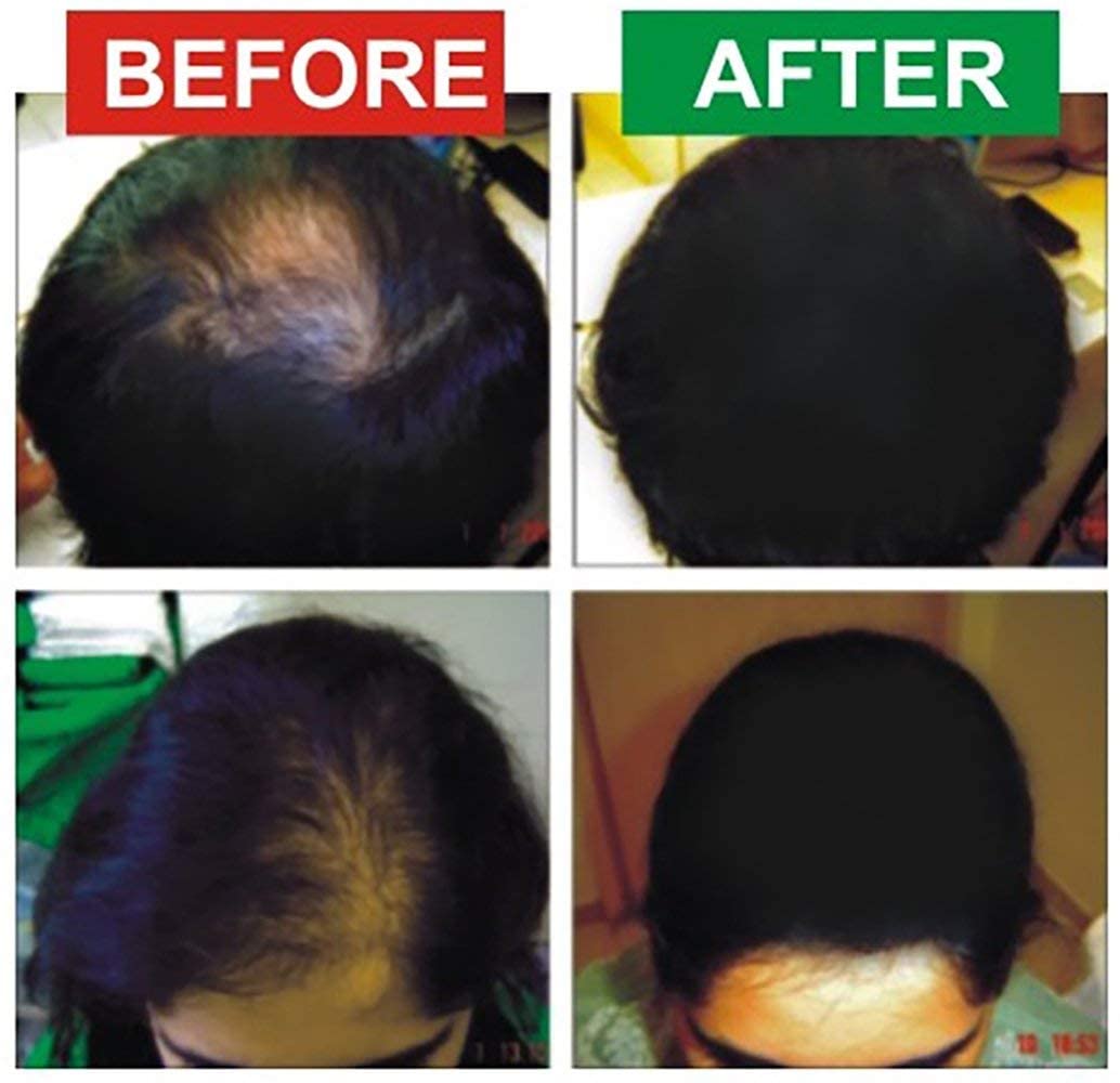 Hairouse Microfiber Powder